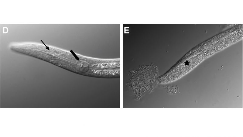 Микробы избавят от червей и глистов