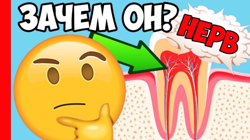 Зачем нужны нервы в зубе